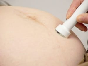 best fetal doppler