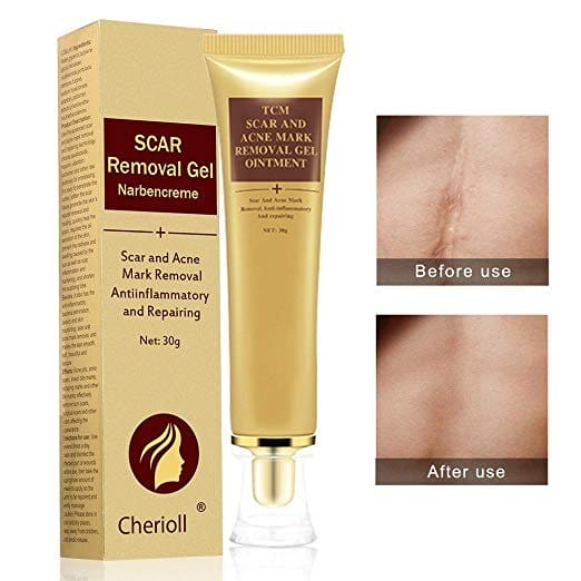 best scar cream