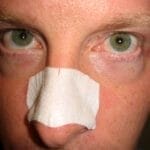 How to use pore strips